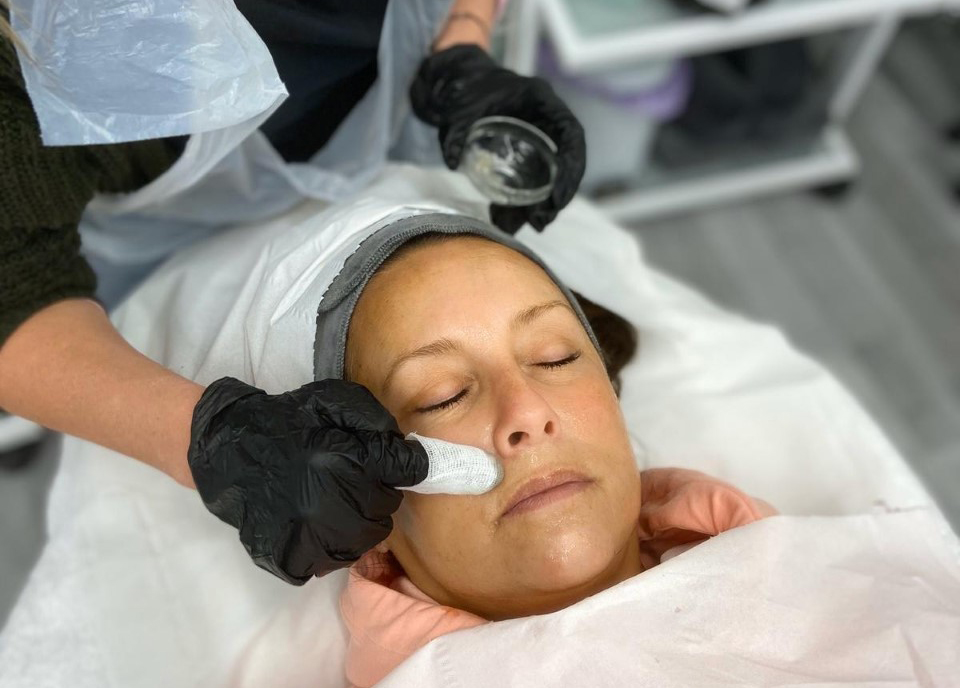 Chemical Peel Course | Foundation Skin Peel Training