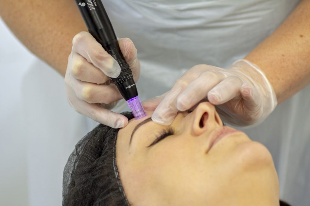 Microneedling Certification Course | Skin Needling Training