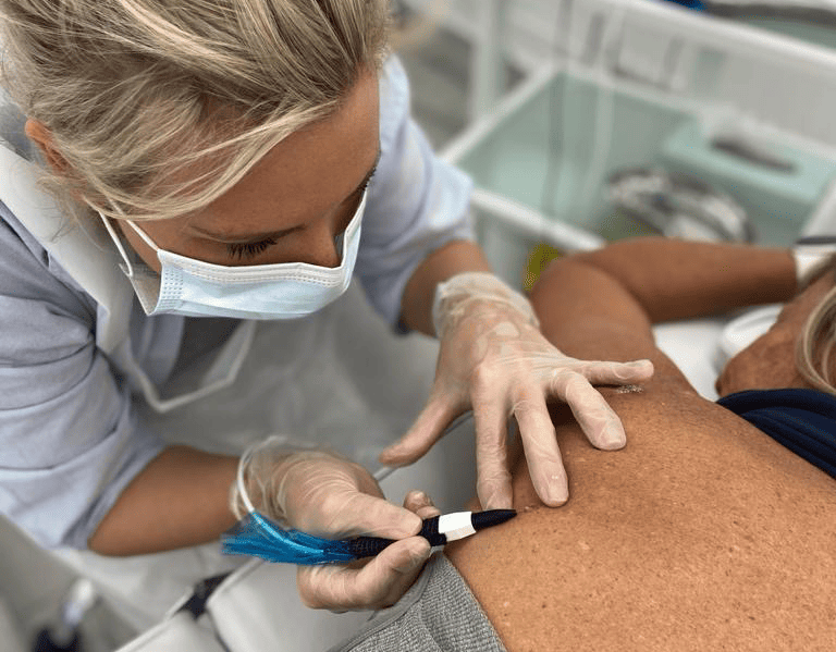LBA Skin Blemish Removal Training Course