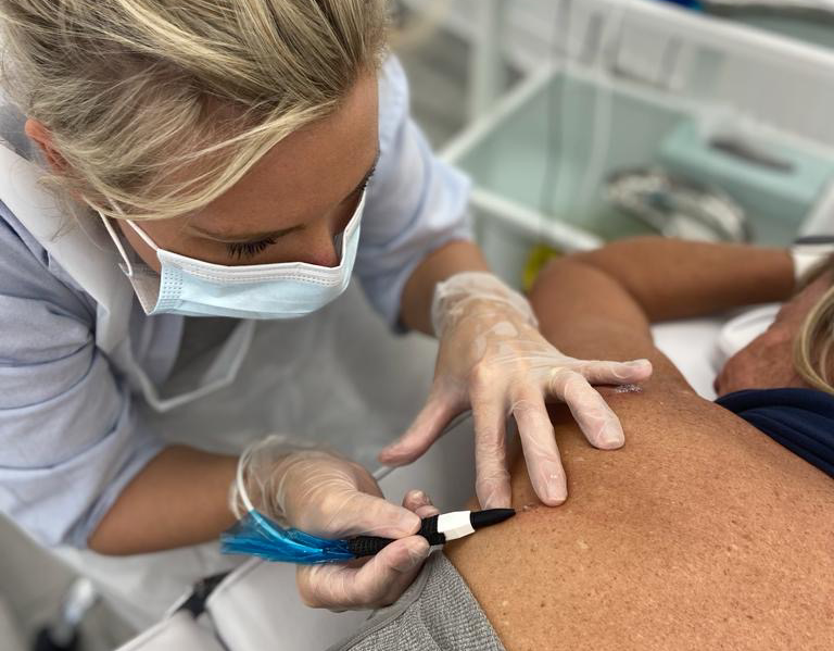Skin Imperfection Removal Training